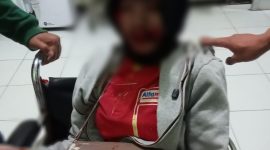 Karyawan toko Alfamart garut di begal orang tidak dikenal, (Foto:Nisa korban pembegalan).