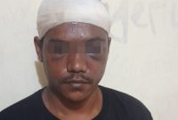Polsek Pameungpeuk berhasil mengamankan seorang tersangka dalam kasus tindak pidana pencurian yang terjadi pada hari Rabu, 5 Maret 2025, sekitar pukul 19.30 WIB, di Kampung Medong, Desa Sirnabakti, Kecamatan Pameungpeuk, Kabupaten Garut.